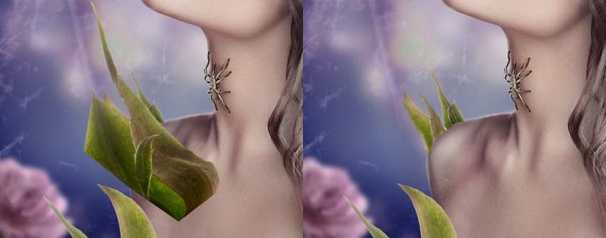 right sepals duplicating